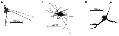 Organization of the ventricular zone of the cerebellum